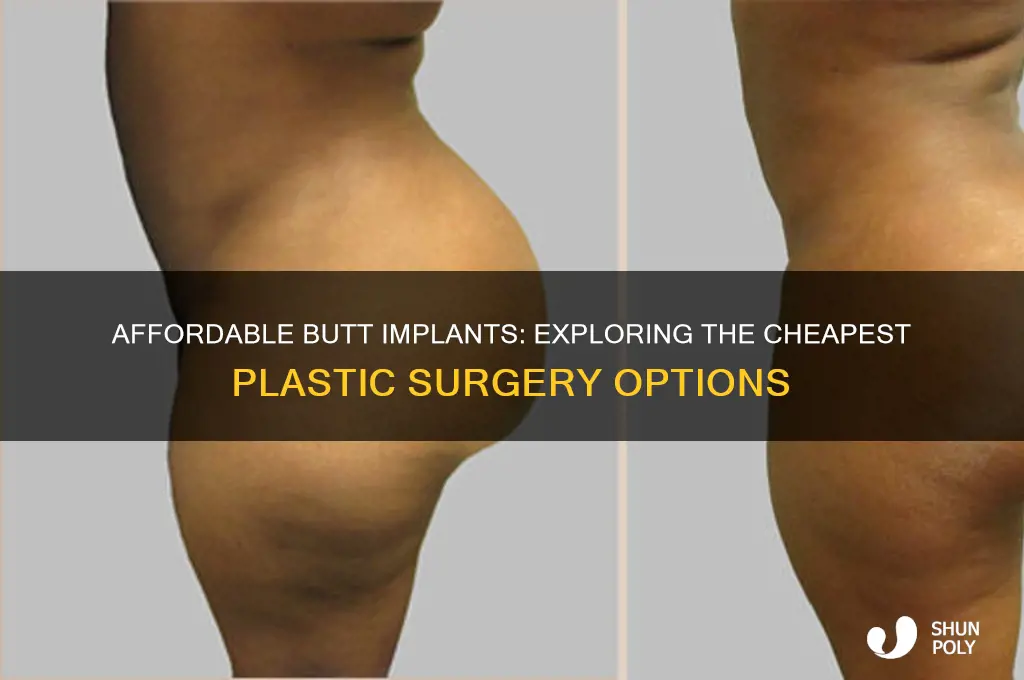 what is the cheapest plastic surgery for butt implants