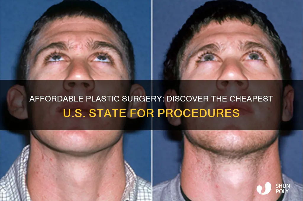 what is the cheapest state for plastic surgery
