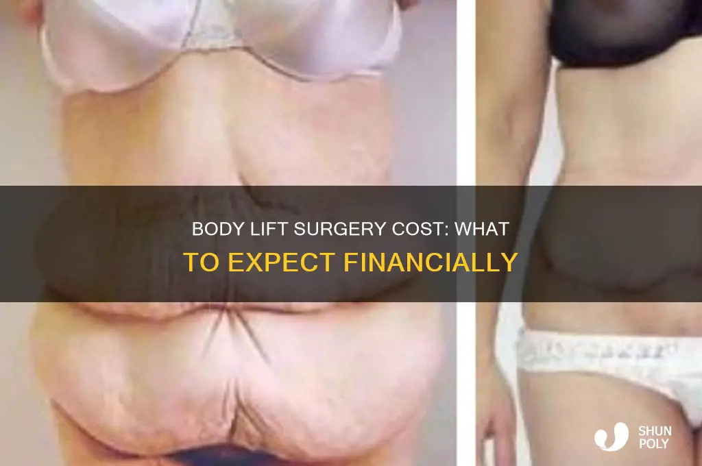 what is the cost of a body lift plastic surgery