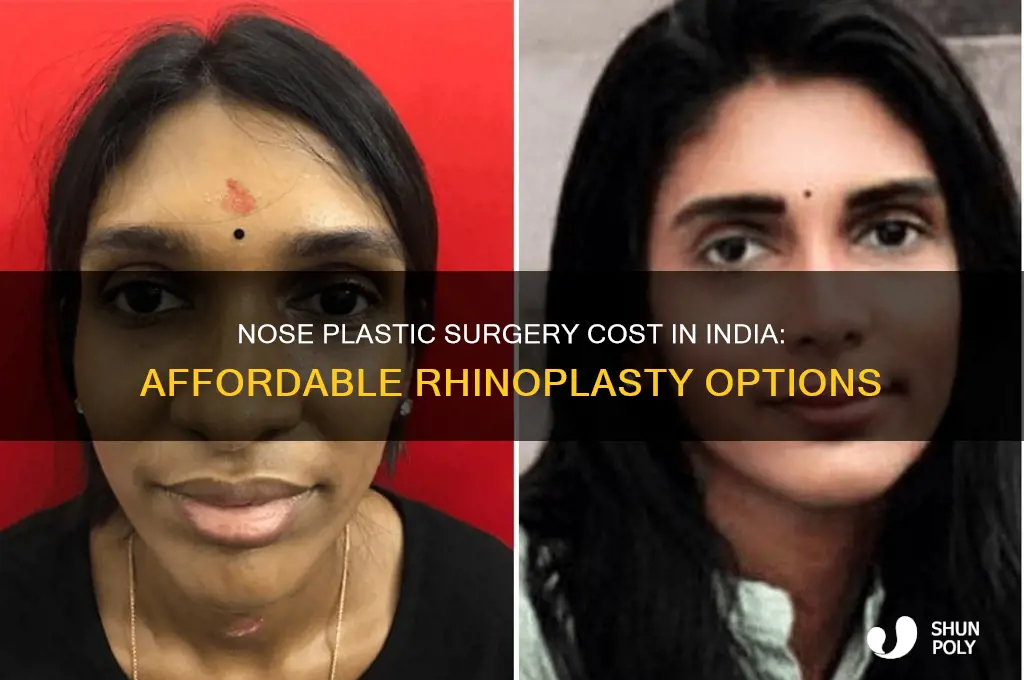 what is the cost of nose plastic surgery in india
