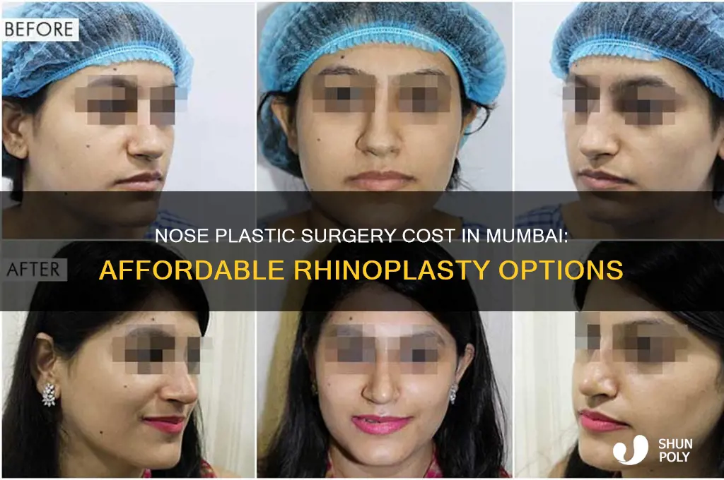 what is the cost of nose plastic surgery in mumbai