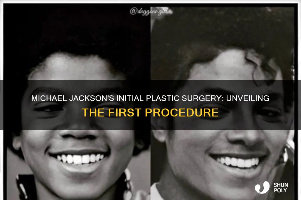 what is the first plastic surgery that michael jackson had