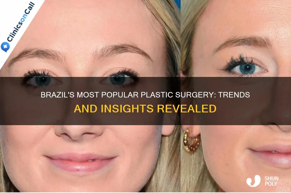 what is the highest plastic surgery in brazil