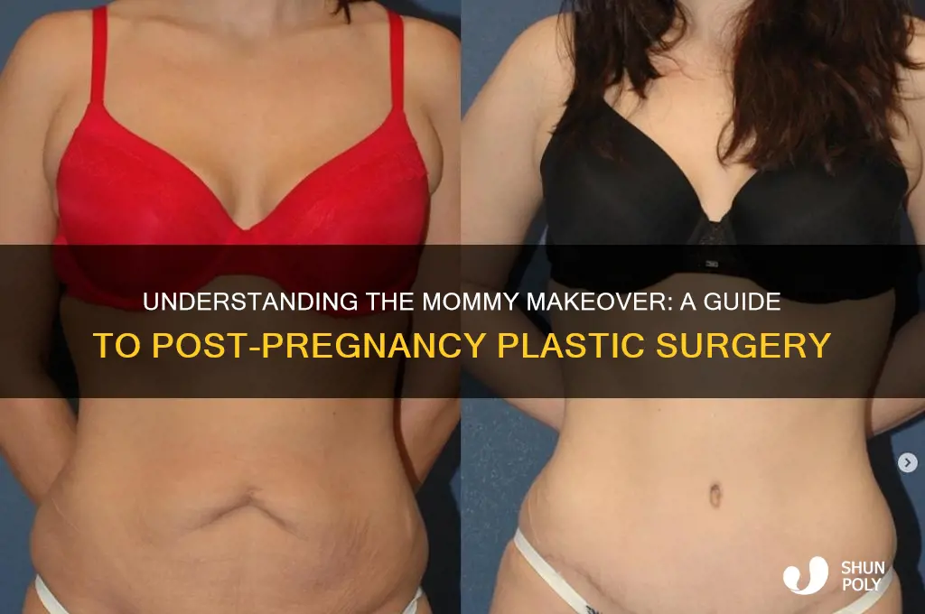 what is the mommy package plastic surgery