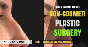 Exploring the Most Common Non-Cosmetic Plastic Surgery Procedures Today