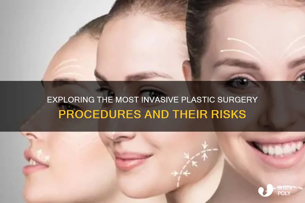 what is the most invasive plastic surgery