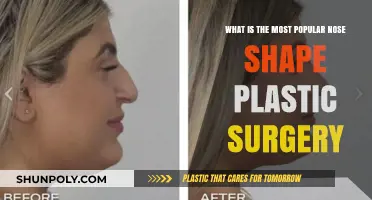 Trending Nose Shapes: Top Rhinoplasty Choices for Facial Harmony