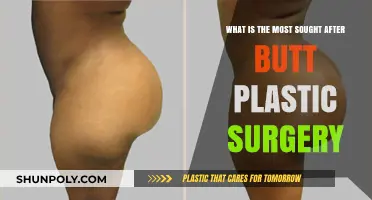 Top Butt Plastic Surgery Trends: Most Desired Procedures Revealed