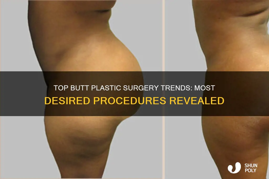 what is the most sought after butt plastic surgery