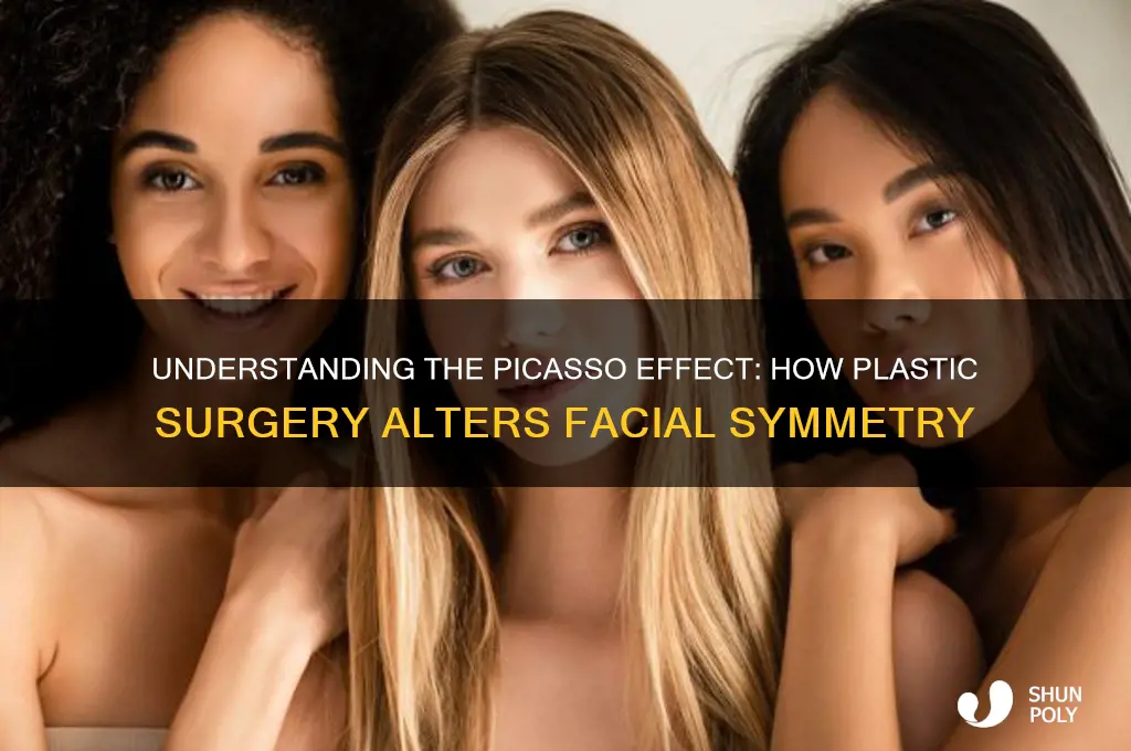 what is the picasso effect plastic surgery
