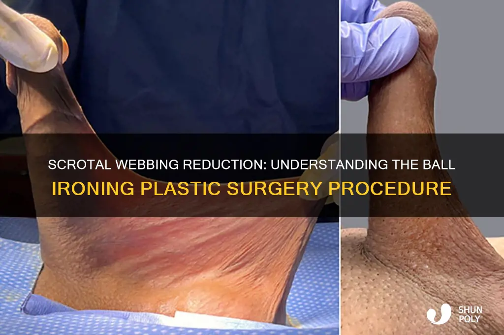 what is the plastic surgery procedure ball ironing