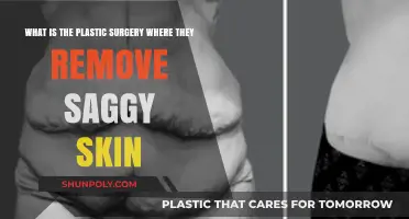 Transform Your Look: Understanding Skin Removal Plastic Surgery Procedures