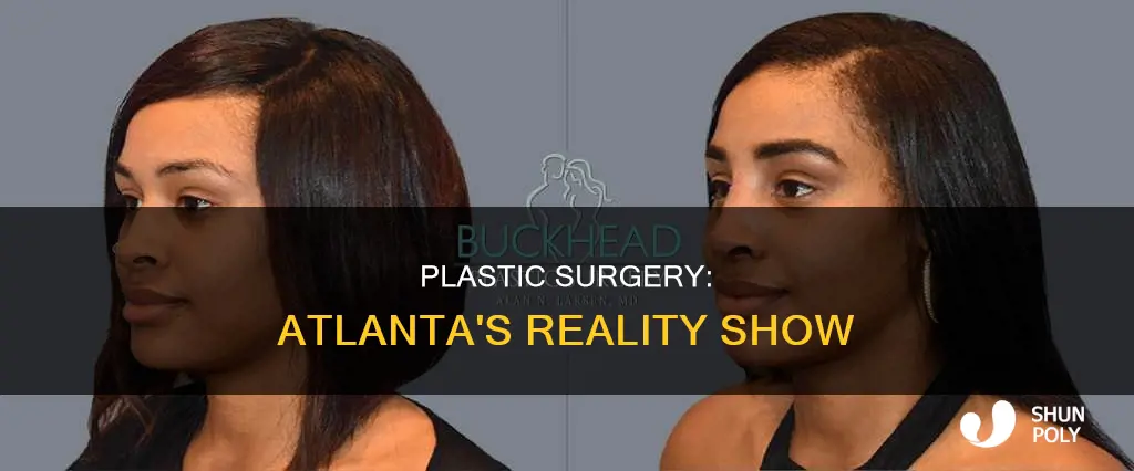 what is the show atlanta plastic about