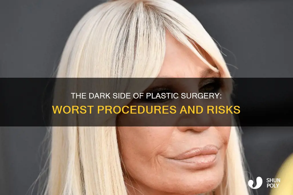what is the worst plastic surgery