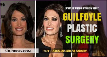Kimberly Guilfoyle's Plastic Surgery: Unveiling the Controversial Transformation