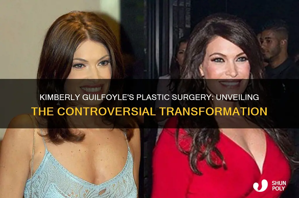 what is wrong with kimberly guilfoyle plastic surgery
