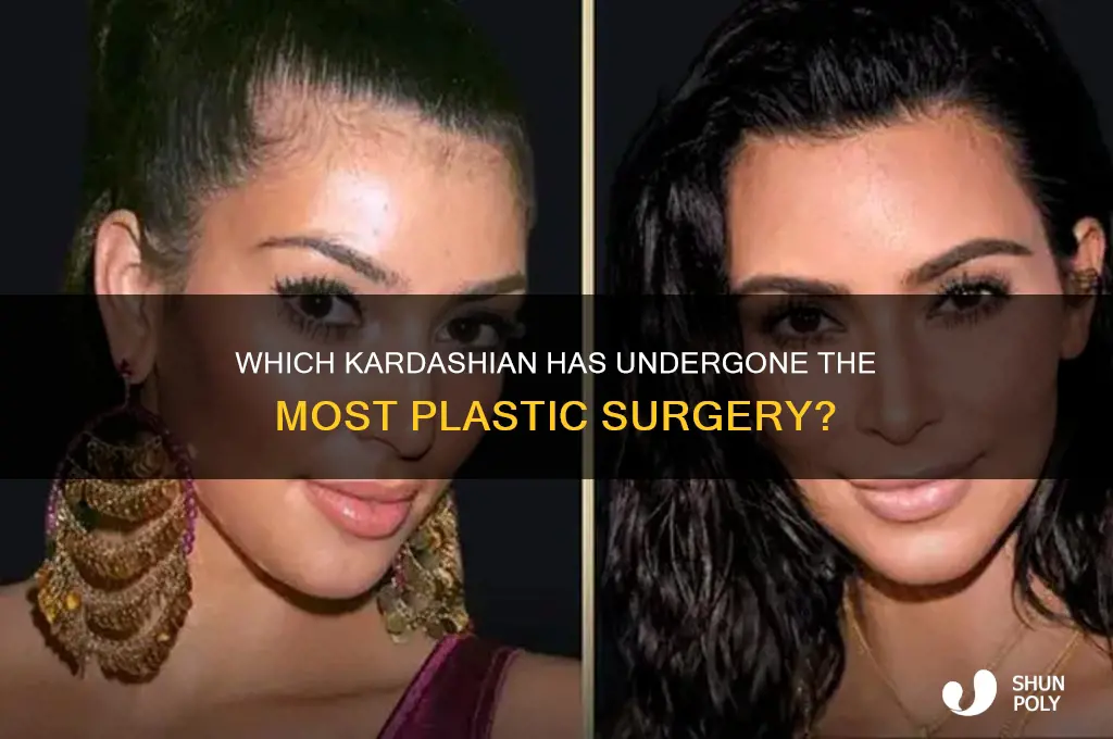 what kardashian has the most plastic surgery