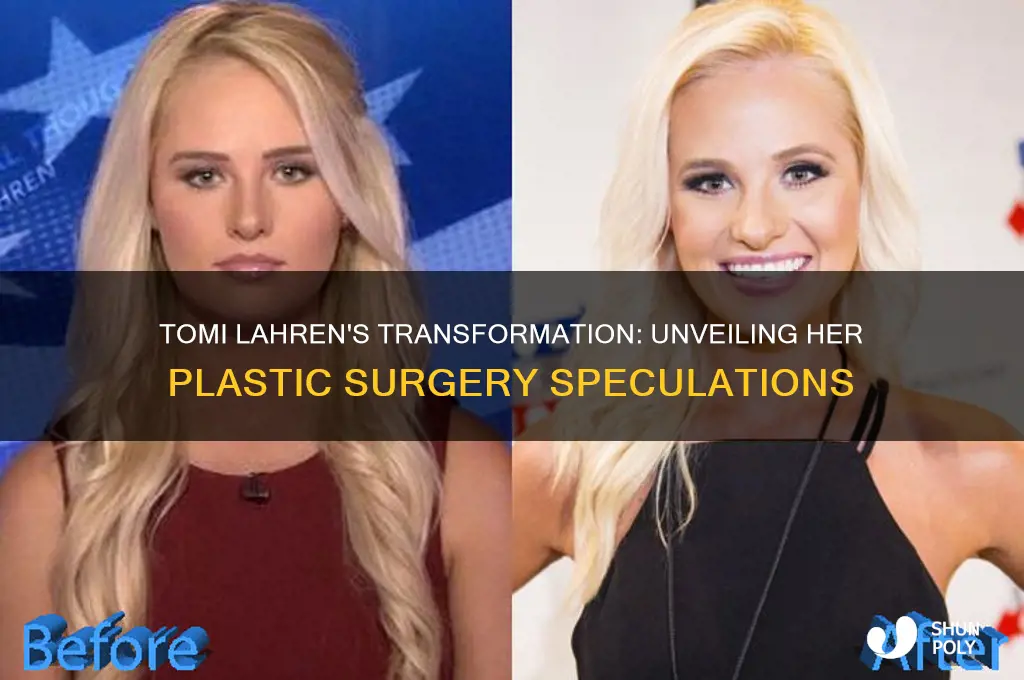what kind of plastic surgeries did tomi lahren get