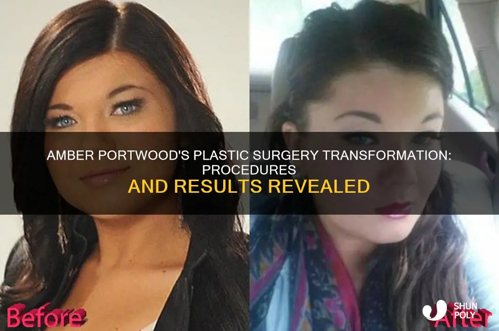 what kind of plastic surgery did amber portwood have