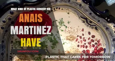 Anais Martinez's Plastic Surgery: Unveiling Her Transformation Journey