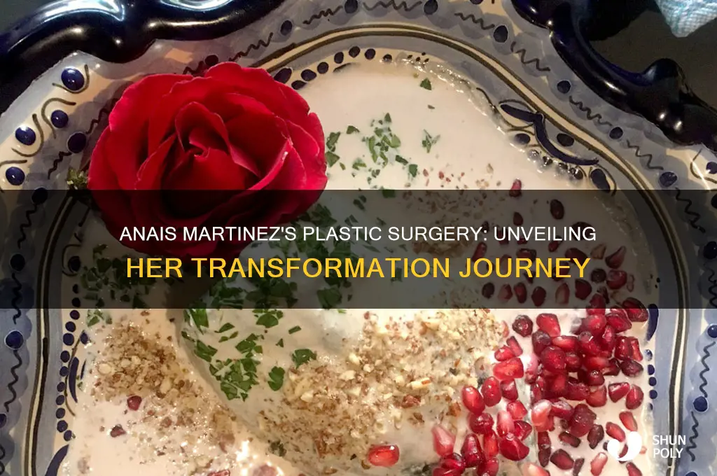 what kind of plastic surgery did anais martinez have