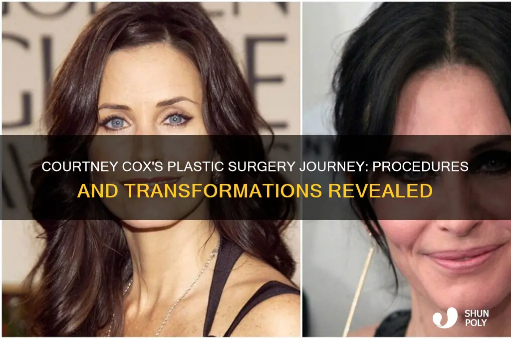 what kind of plastic surgery did courtney cox have