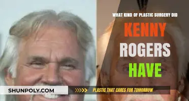 Kenny Rogers' Plastic Surgery: Unveiling the Country Legend's Transformations