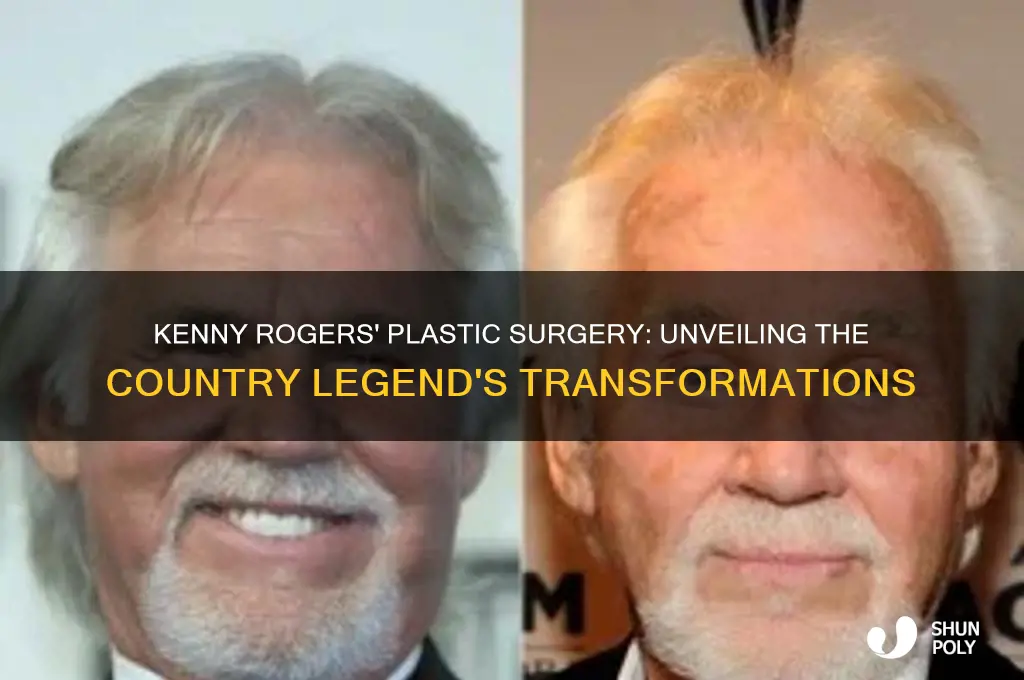 what kind of plastic surgery did kenny rogers have