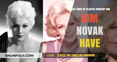 Kim Novak's Plastic Surgery: Unveiling the Truth Behind Her Transformation