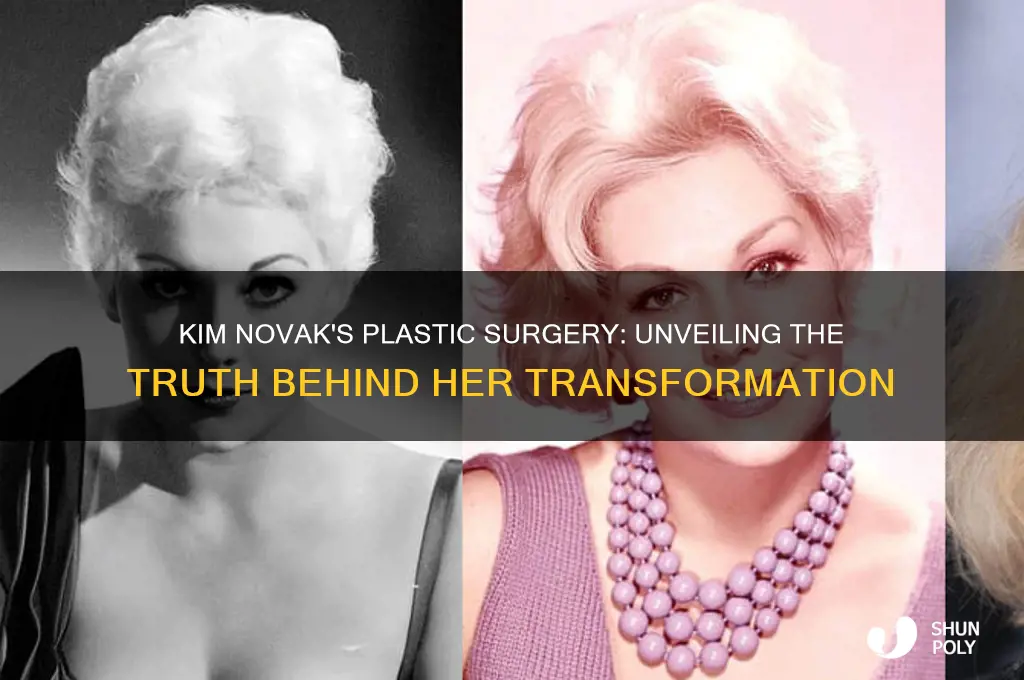 what kind of plastic surgery did kim novak have