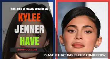 Kylee Jenner's Plastic Surgery: Unveiling Her Transformation Journey