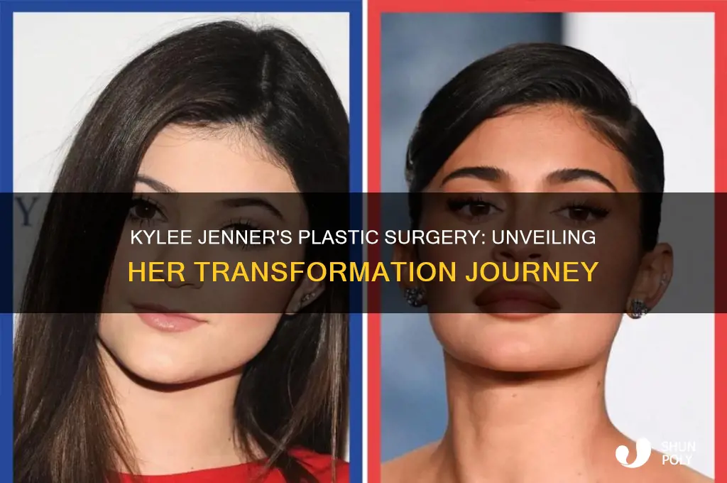what kind of plastic surgery did kylee jenner have