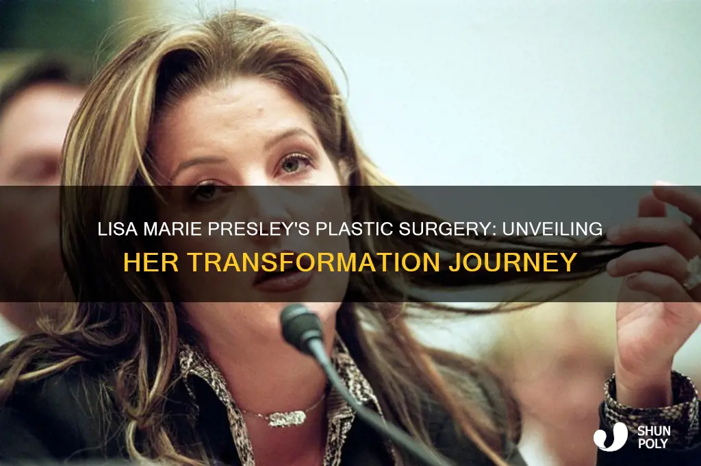 what kind of plastic surgery did lisa marie have