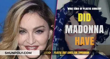 Madonna's Plastic Surgery Journey: Unveiling Her Transformative Procedures