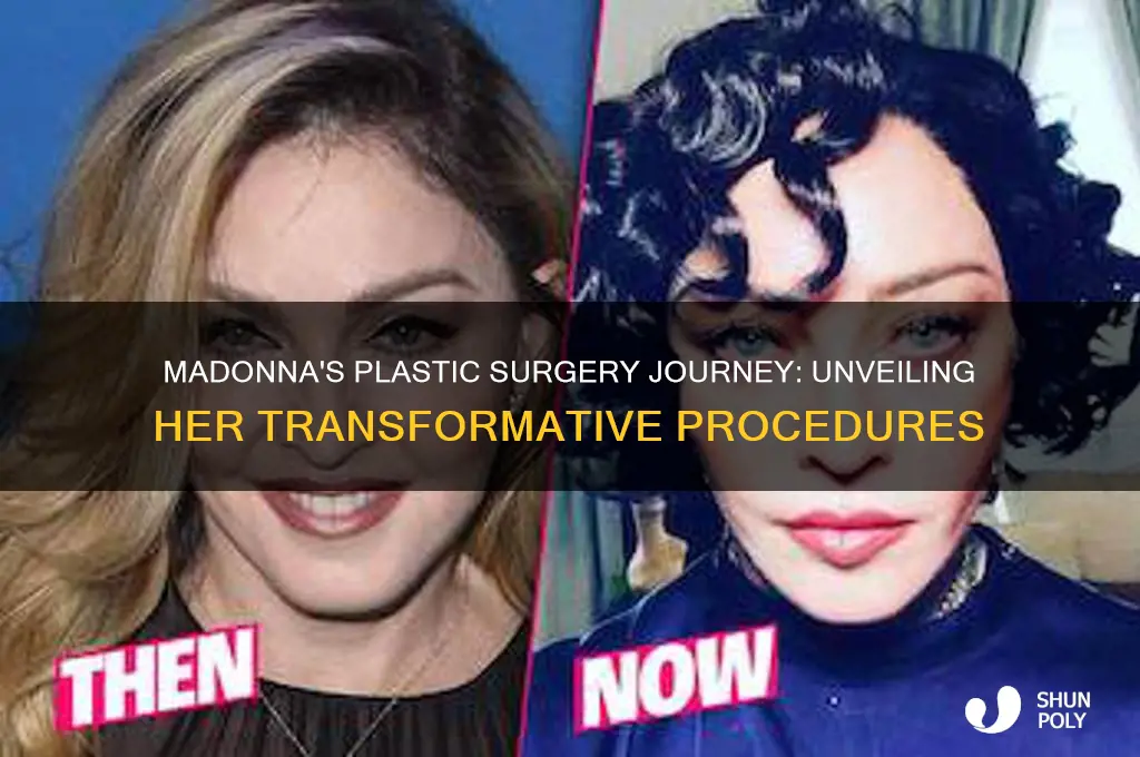 what kind of plastic surgery did madonna have