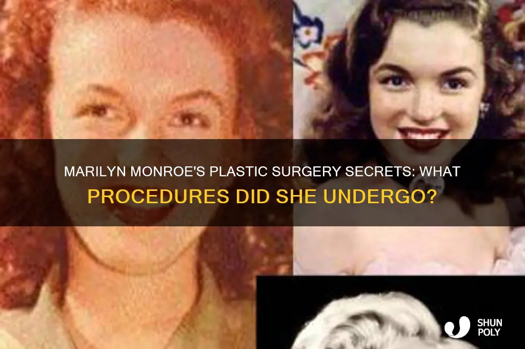 what kind of plastic surgery did marilyn monroe have