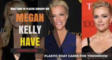 Megan Kelly's Plastic Surgery: Unveiling Her Transformation and Procedures