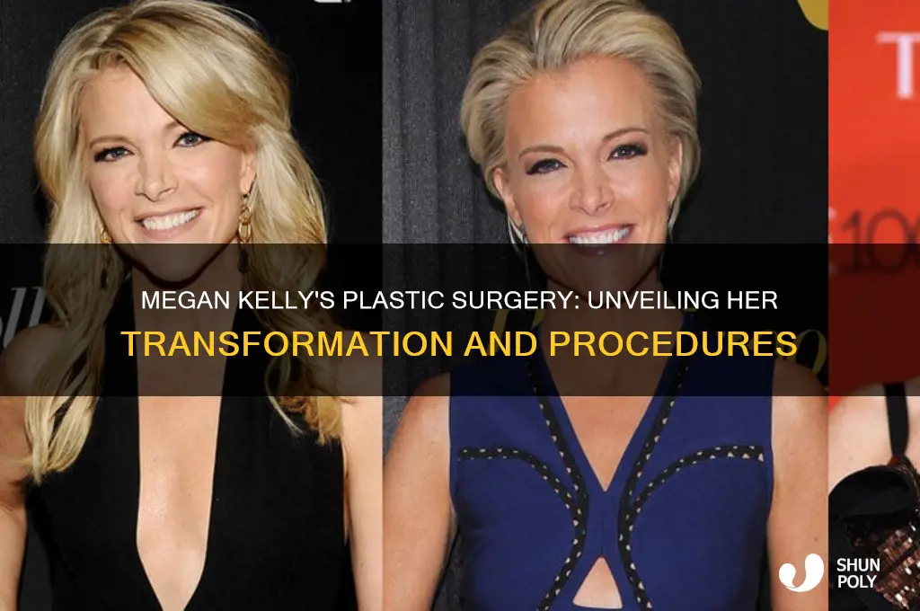 what kind of plastic surgery did megan kelly have
