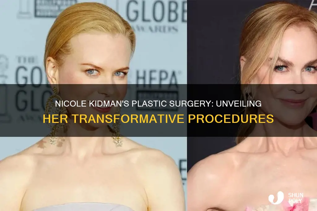 what kind of plastic surgery did nicole kidman have