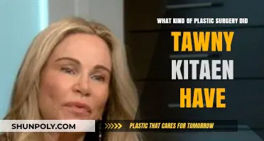 Tawny Kitaen's Plastic Surgery: Unveiling Her Transformation Journey