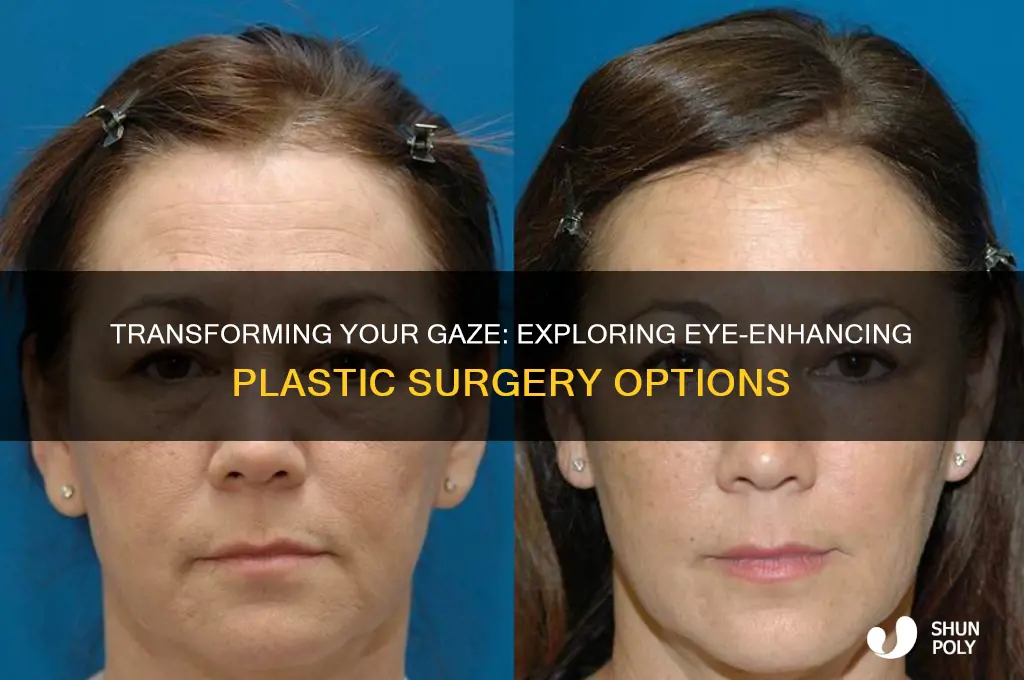 what kind of plastic surgery eyes
