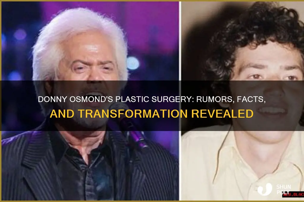 what kind of plastic surgery has donny osmond had