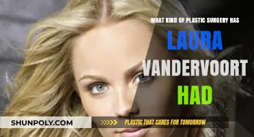 Laura Vandervoort's Plastic Surgery: Rumors, Facts, and Transformations Explored