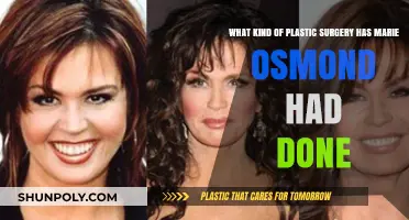 Marie Osmond's Plastic Surgery: Procedures and Transformations Revealed