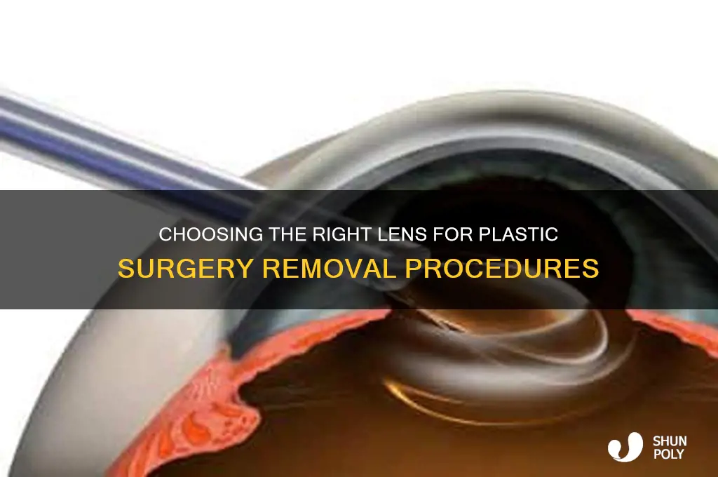 what lens do i need to remove the plastic surgeon