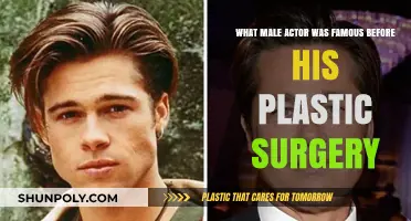 From Fame to Transformation: Male Actor's Pre-Surgery Stardom Revealed