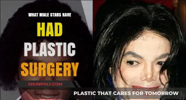 Male Celebrities Who've Gone Under the Knife: Plastic Surgery Revelations