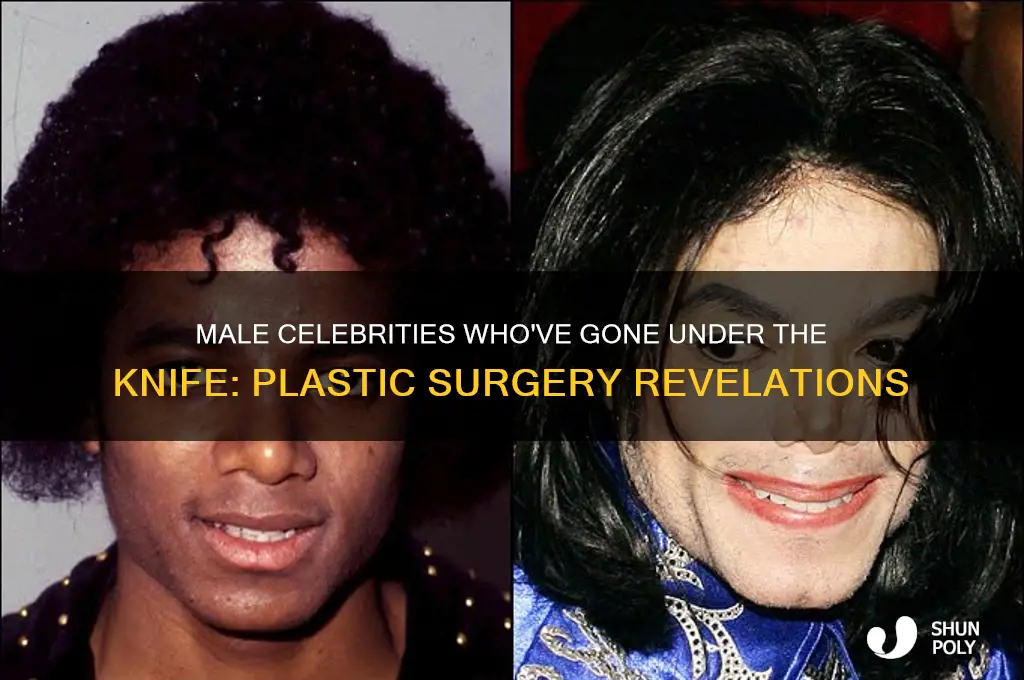 what male stars have had plastic surgery
