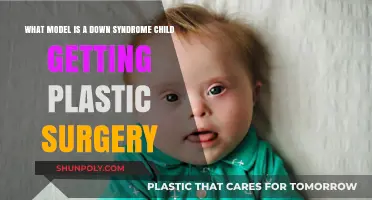 Down Syndrome and Plastic Surgery: Ethical Considerations and Child Welfare