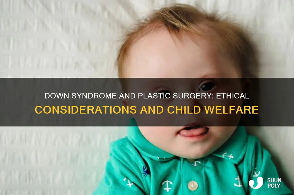 what model is a down syndrome child getting plastic surgery
